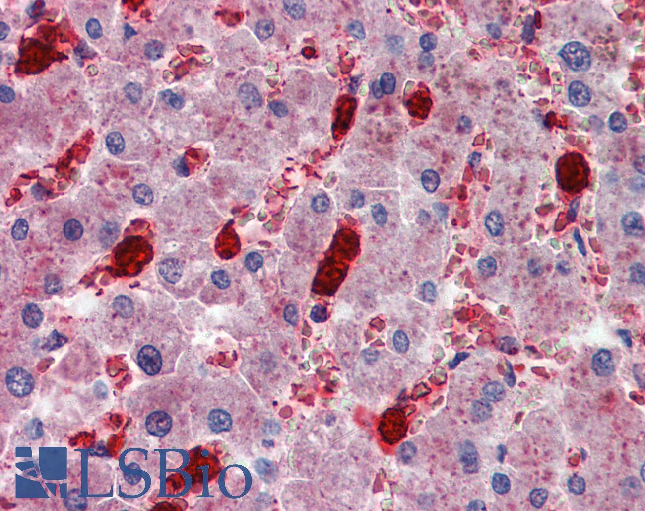 IGSF4C / CADM4 Antibody - Anti-CADM4 / NECL-4 antibody IHC of human liver. Immunohistochemistry of formalin-fixed, paraffin-embedded tissue after heat-induced antigen retrieval. Antibody concentration 2.5 ug/ml.