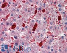 IGSF4C / CADM4 Antibody - Anti-CADM4 / NECL-4 antibody IHC of human liver. Immunohistochemistry of formalin-fixed, paraffin-embedded tissue after heat-induced antigen retrieval. Antibody concentration 2.5 ug/ml.