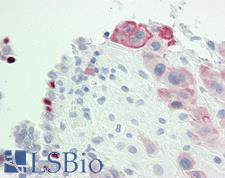 IGSF5 / JAM4 Antibody - Anti-IGSF5 / JAM4 antibody IHC staining of human placenta. Immunohistochemistry of formalin-fixed, paraffin-embedded tissue after heat-induced antigen retrieval. Antibody dilution 1:50.
