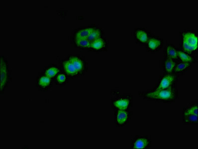 IHH Antibody - Immunofluorescent analysis of HepG2 cells using IHH Antibody at dilution of 1:100 and Alexa Fluor 488-congugated AffiniPure Goat Anti-Rabbit IgG(H+L)