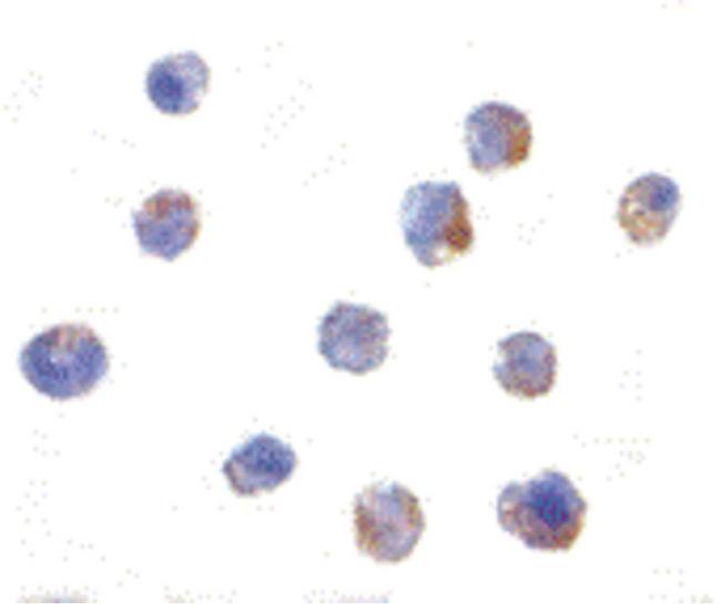 IKBKAP / IKAP Antibody - Immunocytochemistry of IKAP in A-20 cells with IKAP antibody at 1 ug/ml.