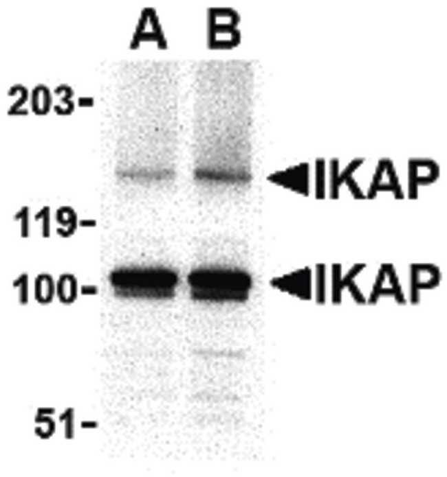 IKBKAP / IKAP Antibody - Western blot of IKAP in A-20 cell lysate with IKAP antibody at in (A) 0.5, and (B) 1 ug/ml.