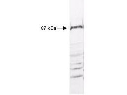 IKBKB / IKK2 / IKK Beta Antibody - Anti-IKKbeta Antibody - Western Blot. Western blot of anti-IKKbeta antibody reacted with HeLa cell extract. All incubations except color development were performed using TBS supplemented with 0.1% Tween-20 at room temperature. The membrane was blocked in 5% dry milk for 2 h. After washing, a 1:500 dilution of the primary antibody was added to the membrane and incubated for 2 h. Washes with buffer were performed 4 times for 5 each. The western blot was incubated with secondary antibody (HRP Goat-a-Rabbit IgG [H&L]) diluted 1:2000 for 1h. Washes with TBS preceded color development.