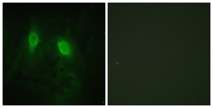 IKBKG / NEMO / IKK Gamma Antibody - Immunofluorescence analysis of HeLa cells, using IKK-gamma Antibody. The picture on the right is blocked with the synthesized peptide.