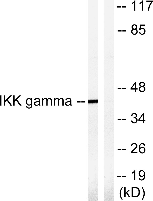 IKBKG / NEMO / IKK Gamma Antibody - Western blot analysis of lysates from HepG2 cells, treated with Anisomycin 0.5uM 5h, using IKK-gamma Antibody. The lane on the right is blocked with the synthesized peptide.
