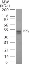 IKBKG / NEMO / IKK Gamma Antibody - Western blot of 30 ug of total cell lysate from Jurkat cells with antibody at 2 ug/ml dilution.
