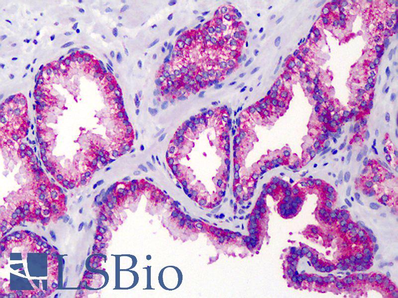 IKBKG / NEMO / IKK Gamma Antibody - Anti-IKBKG / IKK Gamma antibody IHC of human prostate. Immunohistochemistry of formalin-fixed, paraffin-embedded tissue after heat-induced antigen retrieval. Antibody concentration 10 ug/ml.