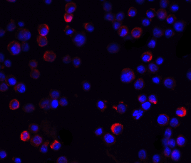 IKBKG / NEMO / IKK Gamma Antibody - Immunofluorescence of IKK gamma in Hela cells with IKK gamma antibody at 20 ug/mL.  Red: IKK gamma Antibody  Blue: DAPI staining