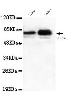 IKZF1 / IKAROS Antibody - Western blot detection of Ikaros(C-terminus) in Ramos and Jurkat cell lysates using Ikaros(C-terminus) mouse monoclonal antibody (1:1000 dilution). Predicted band size: 58KDa. Observed band size: 58KDa.