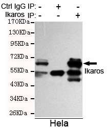 IKZF1 / IKAROS Antibody - Immunoprecipitation analysis of HeLa cell lysate using Ikaros (C-terminus) mouse monoclonal antibody.