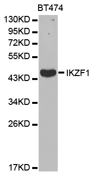 IKZF1 / IKAROS Antibody - Western blot analysis of extracts of BT474 cell lines, using IKZF1 antibody.
