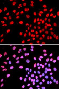 IKZF1 / IKAROS Antibody - Immunofluorescence analysis of U2OS cell using IKZF1 antibody. Blue: DAPI for nuclear staining.