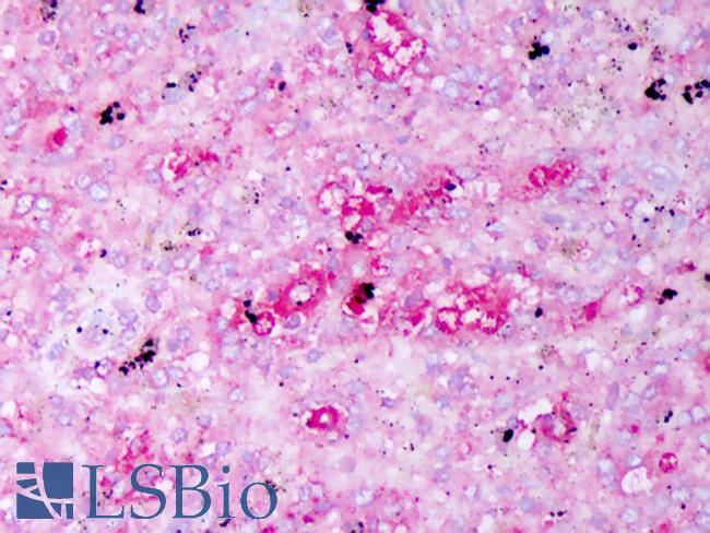 IL-10 Antibody - Anti-IL-10 antibody IHC of human spleen, macrophages. Immunohistochemistry of formalin-fixed, paraffin-embedded tissue after heat-induced antigen retrieval. Antibody concentration 5 ug/ml.