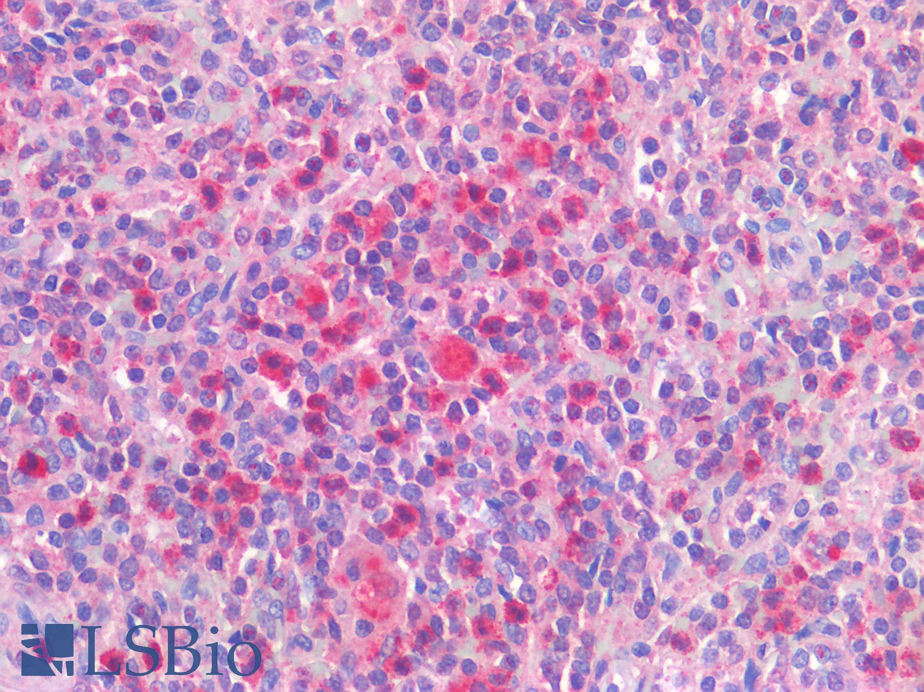 IL-1B / IL-1 Beta Antibody - Human Spleen: Formalin-Fixed, Paraffin-Embedded (FFPE)