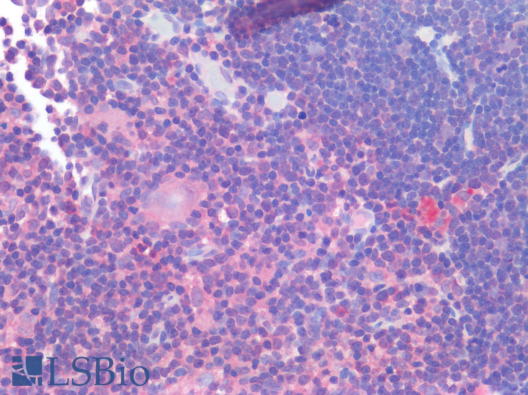 IL-1B / IL-1 Beta Antibody - Human Thymus: Formalin-Fixed, Paraffin-Embedded (FFPE)