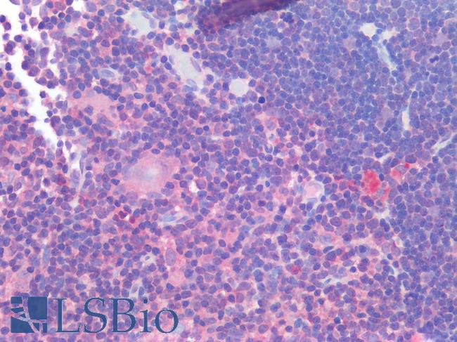 IL-1B / IL-1 Beta Antibody - Human Thymus: Formalin-Fixed, Paraffin-Embedded (FFPE)