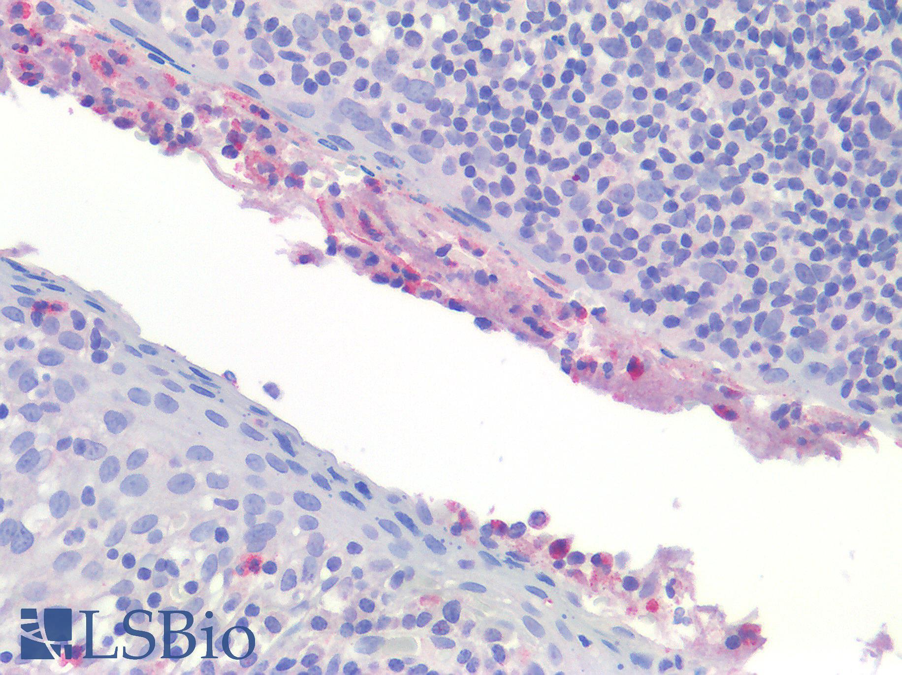 IL-1B / IL-1 Beta Antibody - Human Tonsil: Formalin-Fixed, Paraffin-Embedded (FFPE)