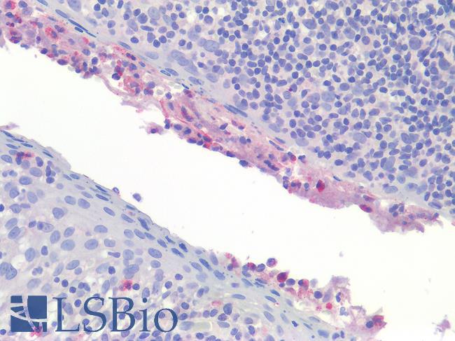 IL-1B / IL-1 Beta Antibody - Human Tonsil: Formalin-Fixed, Paraffin-Embedded (FFPE)