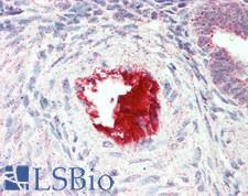 IL-1B / IL-1 Beta Antibody - Human Uterus, Vessel: Formalin-Fixed, Paraffin-Embedded (FFPE)