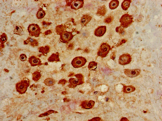 IL-22BP / IL22RA2 Antibody - Immunohistochemistry of paraffin-embedded human placenta tissue using IL22RA2 Antibody at dilution of 1:100