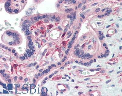 IL-22BP / IL22RA2 Antibody - Human Placenta: Formalin-Fixed, Paraffin-Embedded (FFPE), at a concentration of 10 ug/ml. 