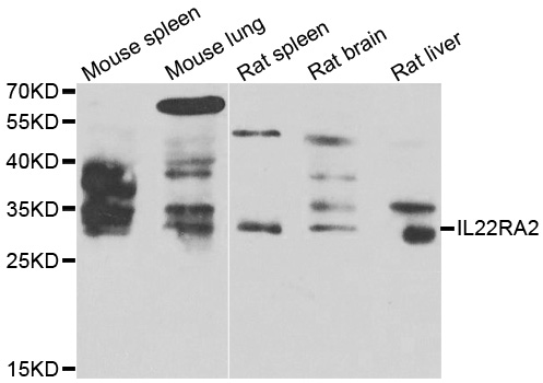 IL-22BP / IL22RA2 Antibody - Western blot analysis of extracts of various cell lines.