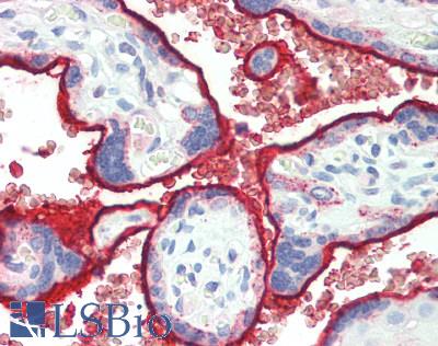 IL-22BP / IL22RA2 Antibody - Human Placenta: Formalin-Fixed, Paraffin-Embedded (FFPE)