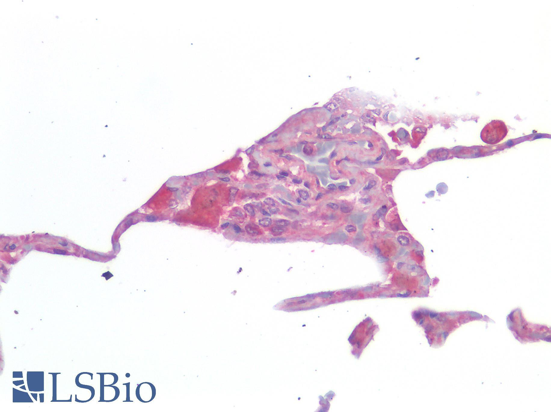 IL-33 Antibody - Human Lung: Formalin-Fixed, Paraffin-Embedded (FFPE)