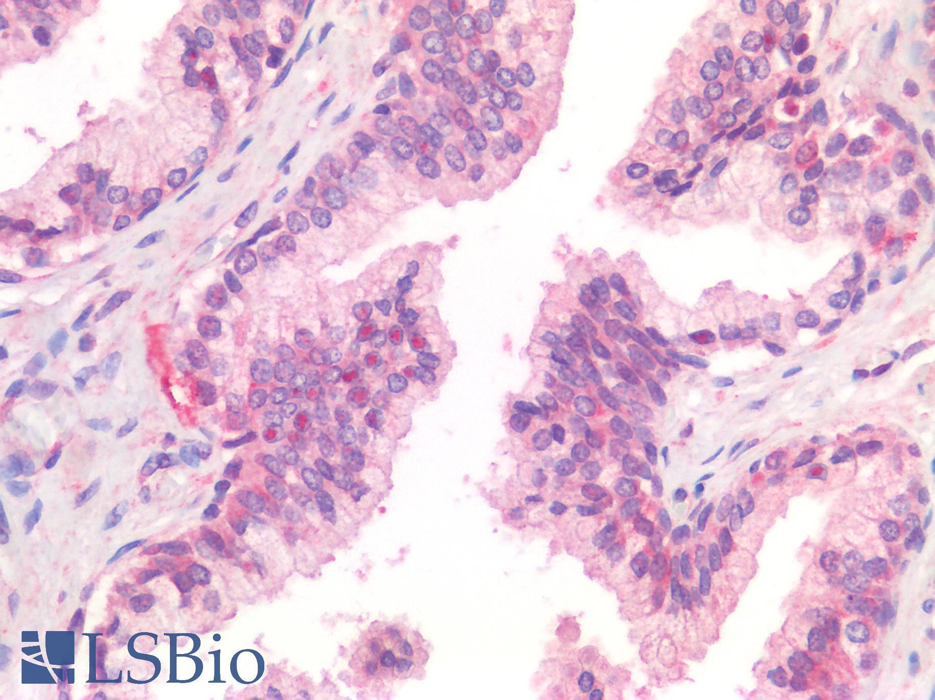 IL-33 Antibody - Human Prostate: Formalin-Fixed, Paraffin-Embedded (FFPE)