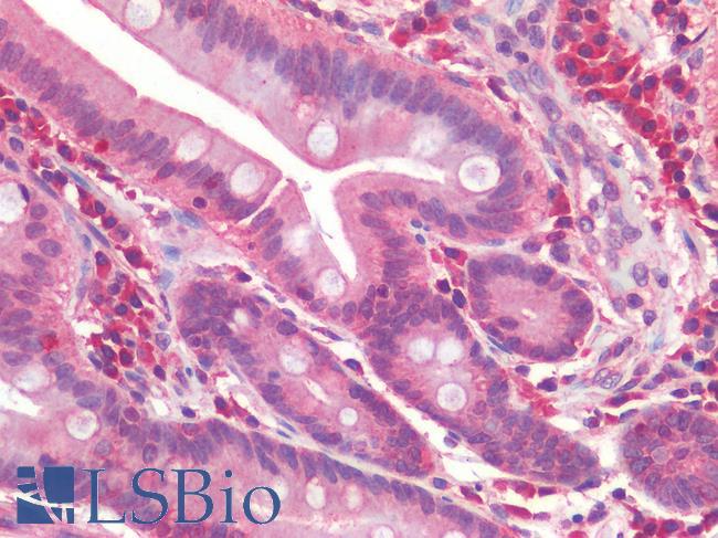 IL-33 Antibody - Human Small Intestine: Formalin-Fixed, Paraffin-Embedded (FFPE)