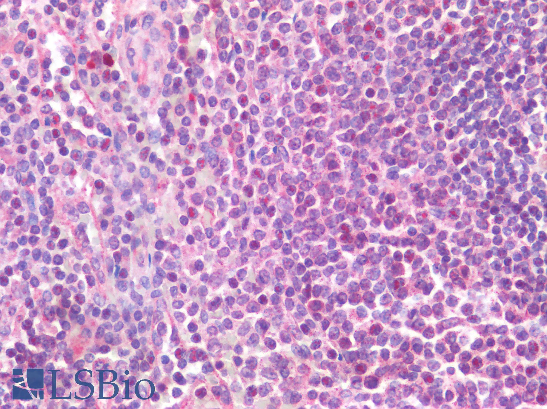 IL-33 Antibody - Human Spleen: Formalin-Fixed, Paraffin-Embedded (FFPE)
