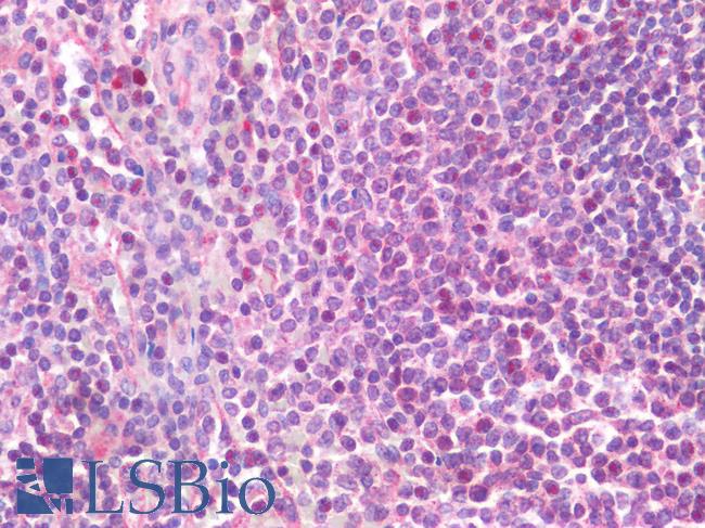 IL-33 Antibody - Human Spleen: Formalin-Fixed, Paraffin-Embedded (FFPE)