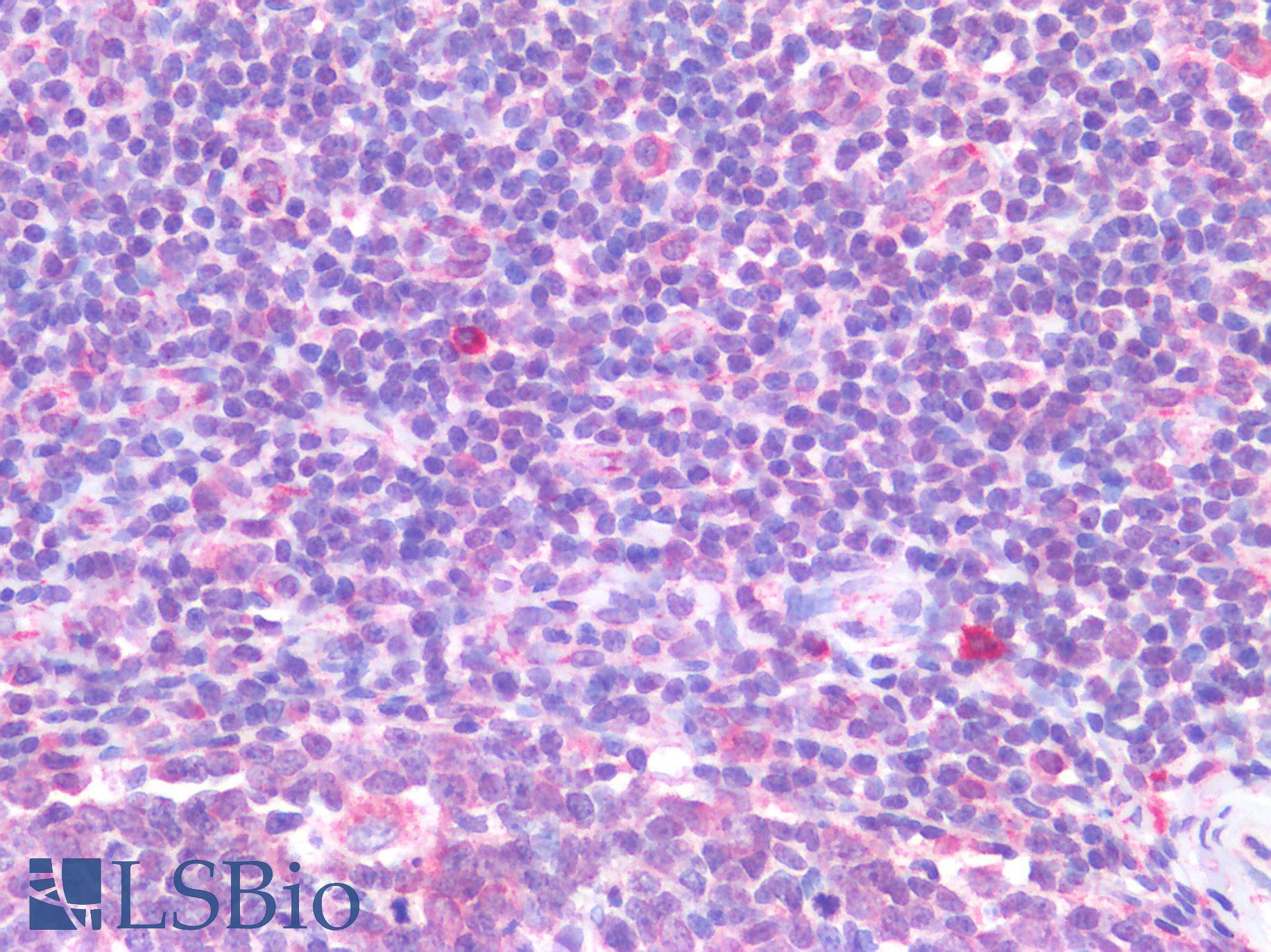 IL-33 Antibody - Human Tonsil: Formalin-Fixed, Paraffin-Embedded (FFPE)