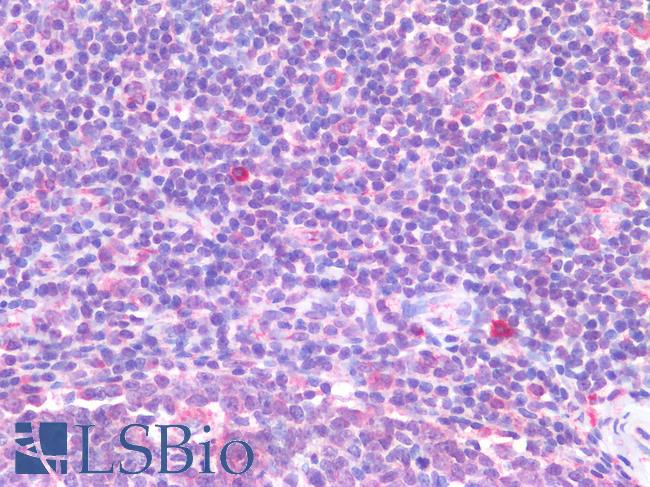 IL-33 Antibody - Human Tonsil: Formalin-Fixed, Paraffin-Embedded (FFPE)