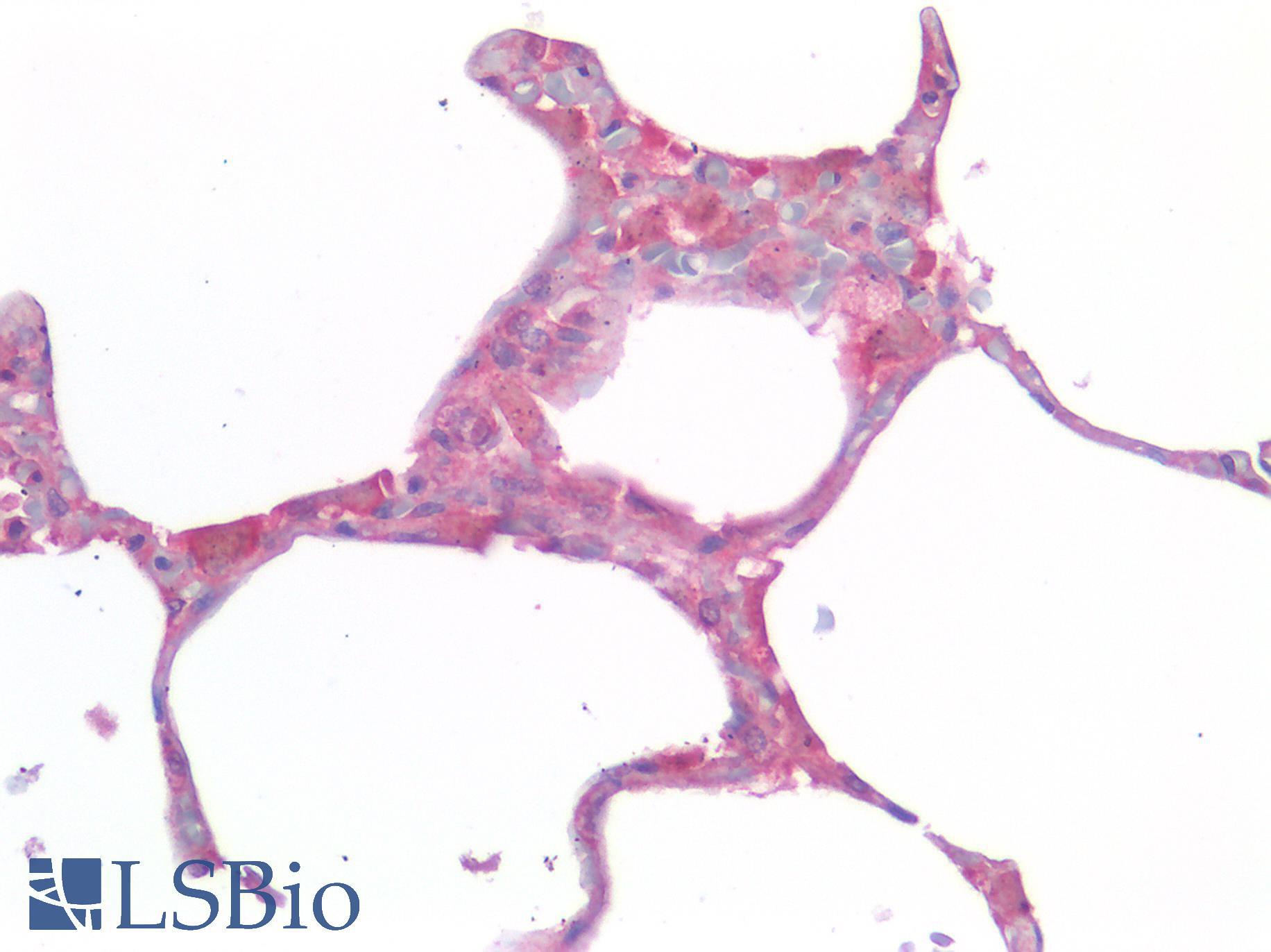 IL-33 Antibody - Human Lung: Formalin-Fixed, Paraffin-Embedded (FFPE)