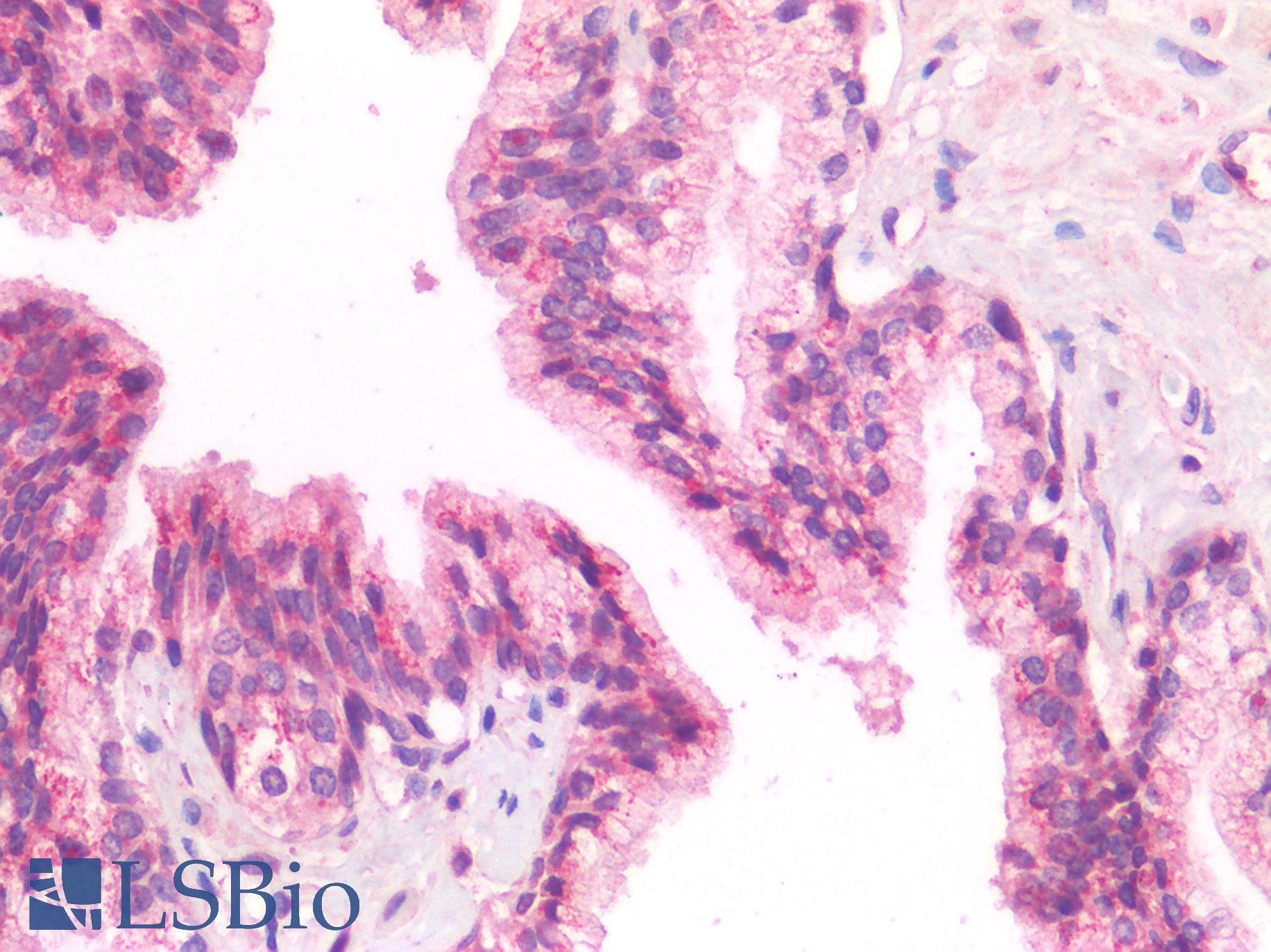 IL-33 Antibody - Human Prostate: Formalin-Fixed, Paraffin-Embedded (FFPE)