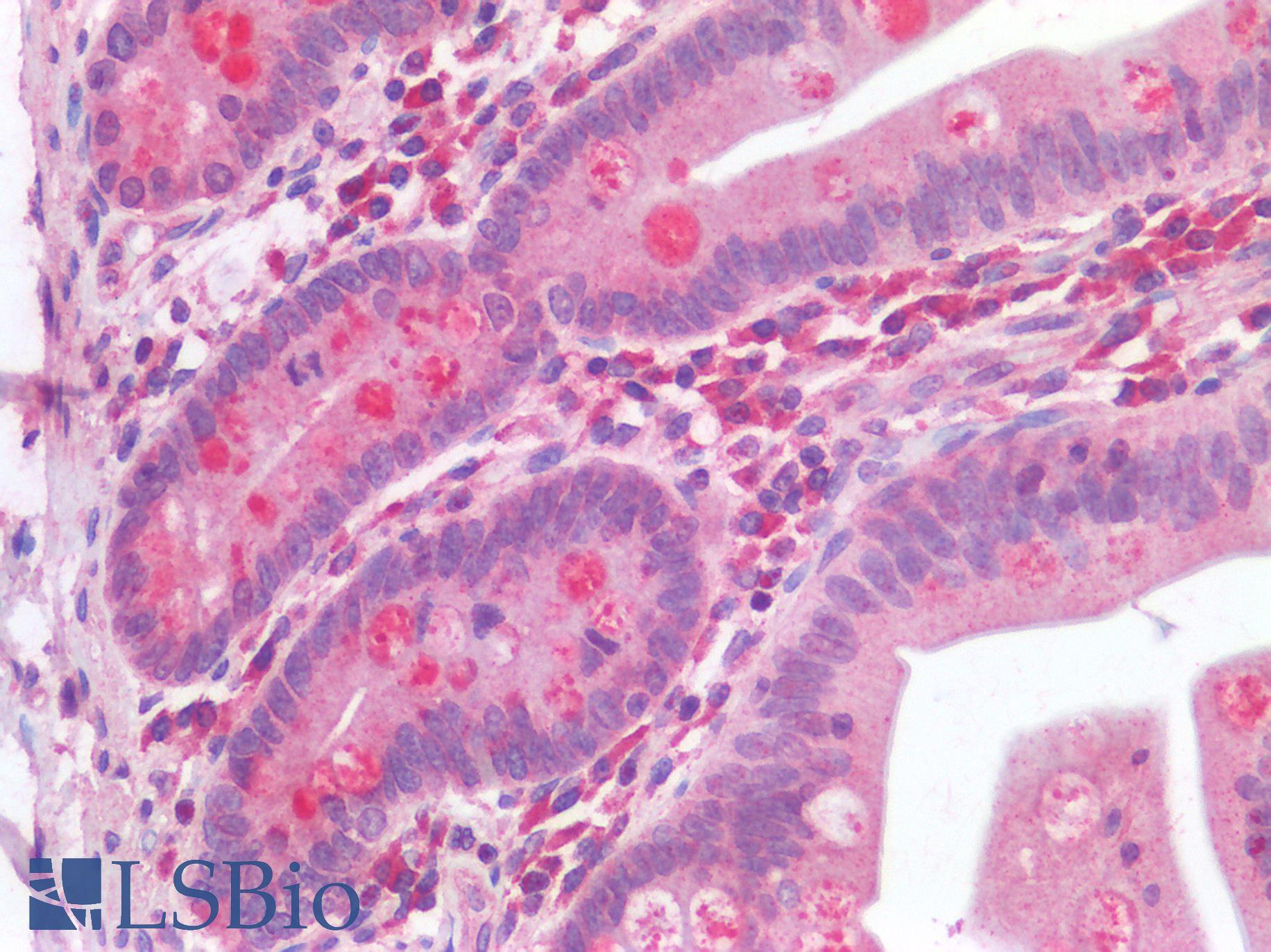 IL-33 Antibody - Human Small Intestine: Formalin-Fixed, Paraffin-Embedded (FFPE)