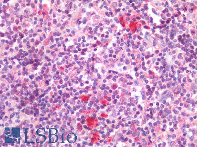 IL-33 Antibody - Human Spleen: Formalin-Fixed, Paraffin-Embedded (FFPE)