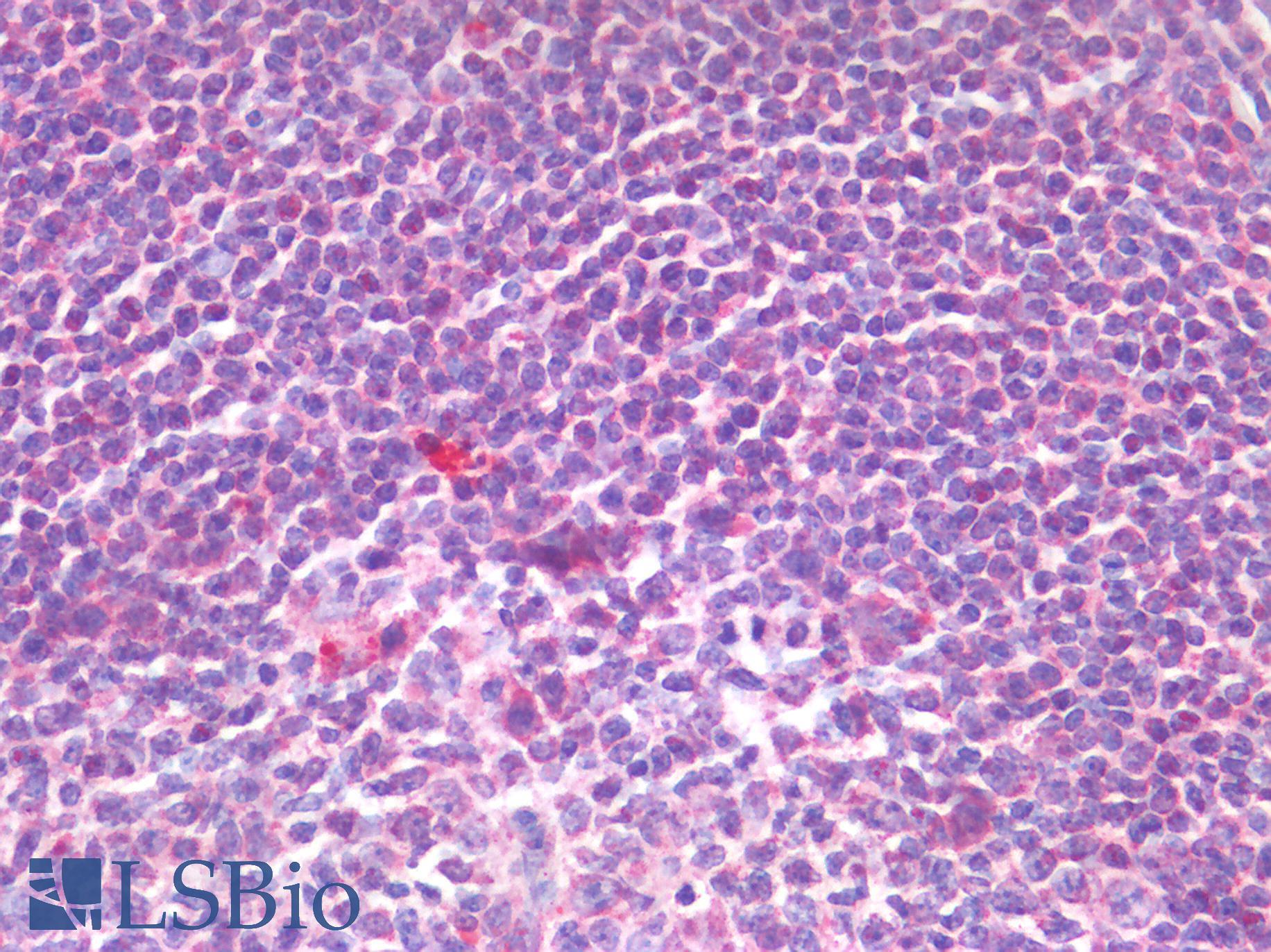 IL-33 Antibody - Human Tonsil: Formalin-Fixed, Paraffin-Embedded (FFPE)