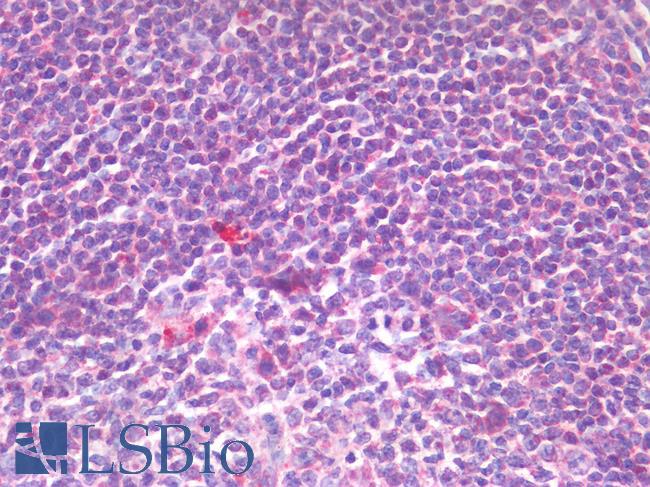 IL-33 Antibody - Human Tonsil: Formalin-Fixed, Paraffin-Embedded (FFPE)