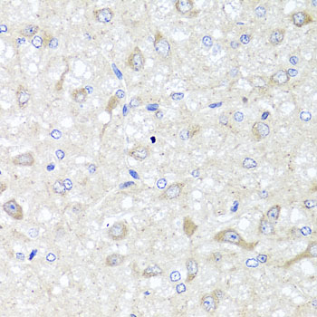 IL-33 Antibody - Immunohistochemistry of paraffin-embedded rat brain tissue, at a dilution of 1:100