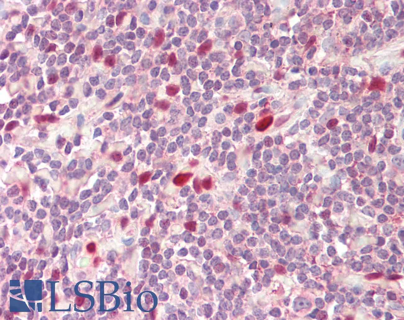 IL-33 Antibody - Small intestine: Formalin-Fixed, Paraffin-Embedded (FFPE), at a dilution of 1:200