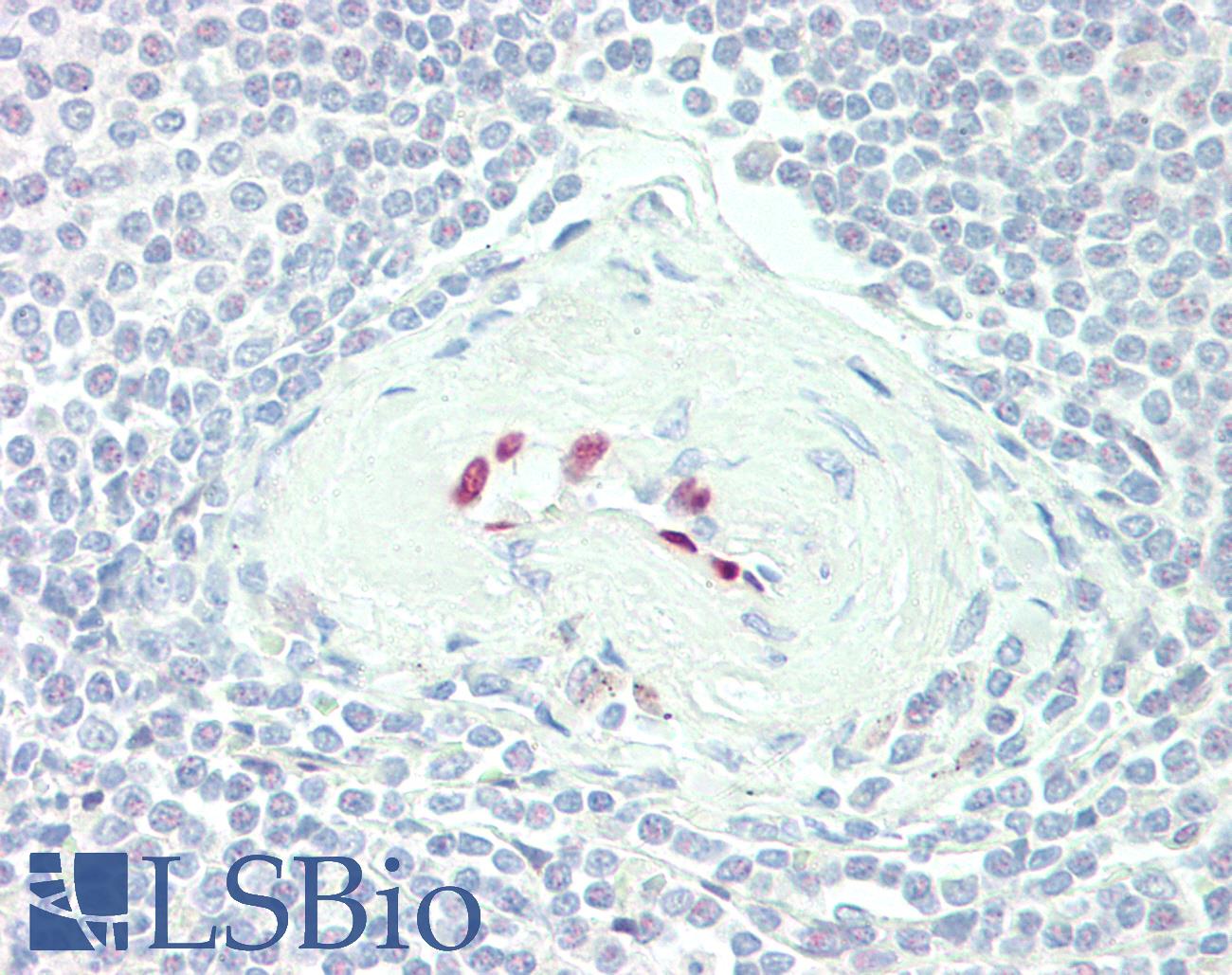 IL-33 Antibody - MALT; Spleen: Formalin-Fixed, Paraffin-Embedded (FFPE), at a dilution of 1:200