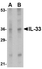IL-33 Antibody - Western blot of IL-33 in human lymph node tissue lysate with IL-33 antibody at (A) 1 and (B) 2 ug/ml.
