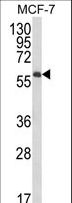 IL10RA Antibody - Western blot of IL10RA Antibody in MCF-7 cell line lysates (35 ug/lane). IL10RA (arrow) was detected using the purified antibody.