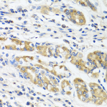 IL11 Antibody - Immunohistochemistry of paraffin-embedded human stomach tissue.