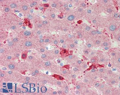 IL11 Antibody - Human Liver: Formalin-Fixed, Paraffin-Embedded (FFPE)