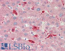 IL11 Antibody - Human Liver: Formalin-Fixed, Paraffin-Embedded (FFPE)