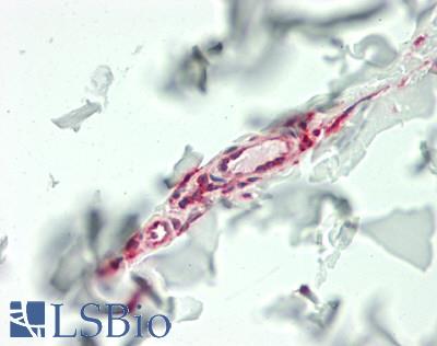IL11 Antibody - Human Skin, Dermal Capillaries: Formalin-Fixed, Paraffin-Embedded (FFPE)