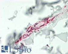 IL11 Antibody - Human Skin, Dermal Capillaries: Formalin-Fixed, Paraffin-Embedded (FFPE)